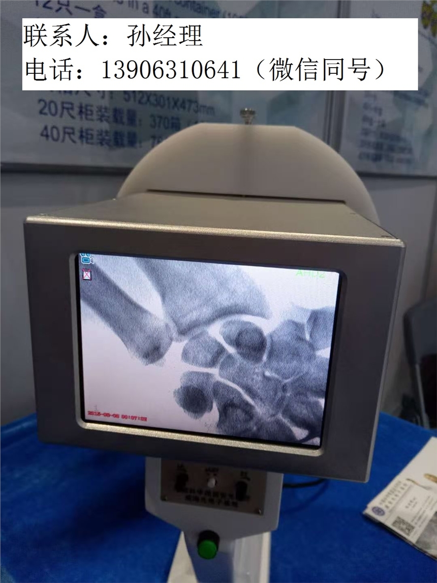 չ^ֹռ⮐ñyXC(j)ԼʽXC(j)